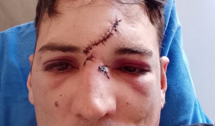 Ajuda pos acidente de moto e carreta